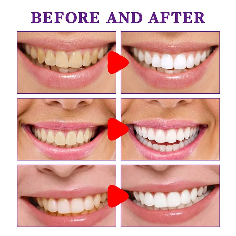 Purple Dental Beauty Toothpaste